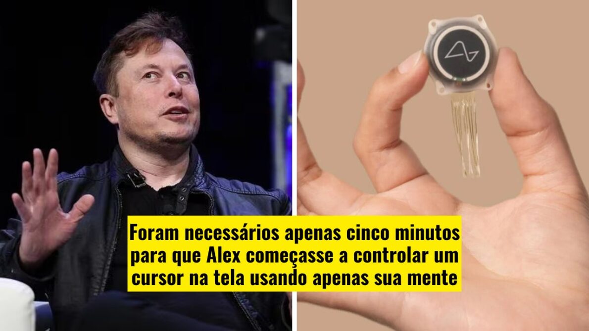 Elon Musk compartilha o progresso do segundo paciente com implante Neuralink, que já joga 'Counter-Strike' com o chip