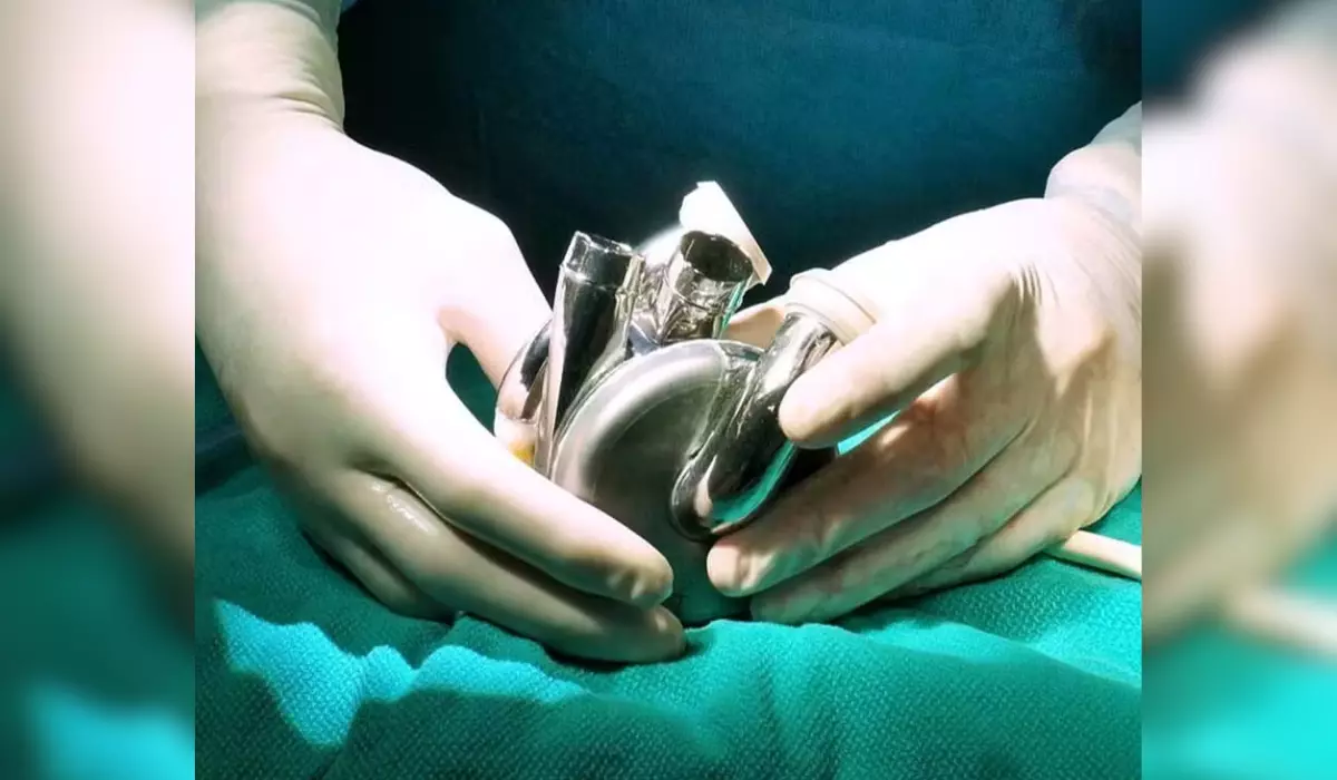 ¡El primer corazón artificial hecho de titanio del mundo fue implantado con éxito en un paciente humano y esto lo cambia todo!