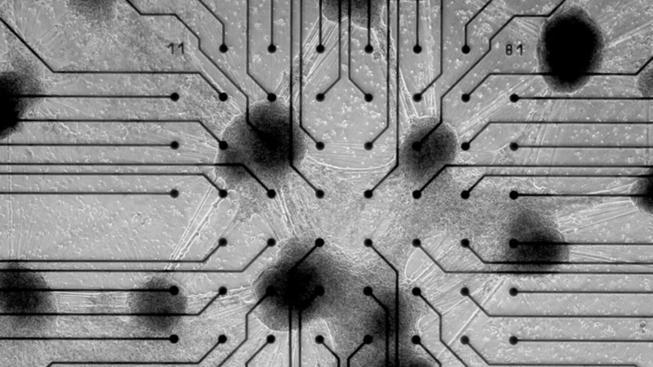 tecnología - computadora - neuronas - cerebro