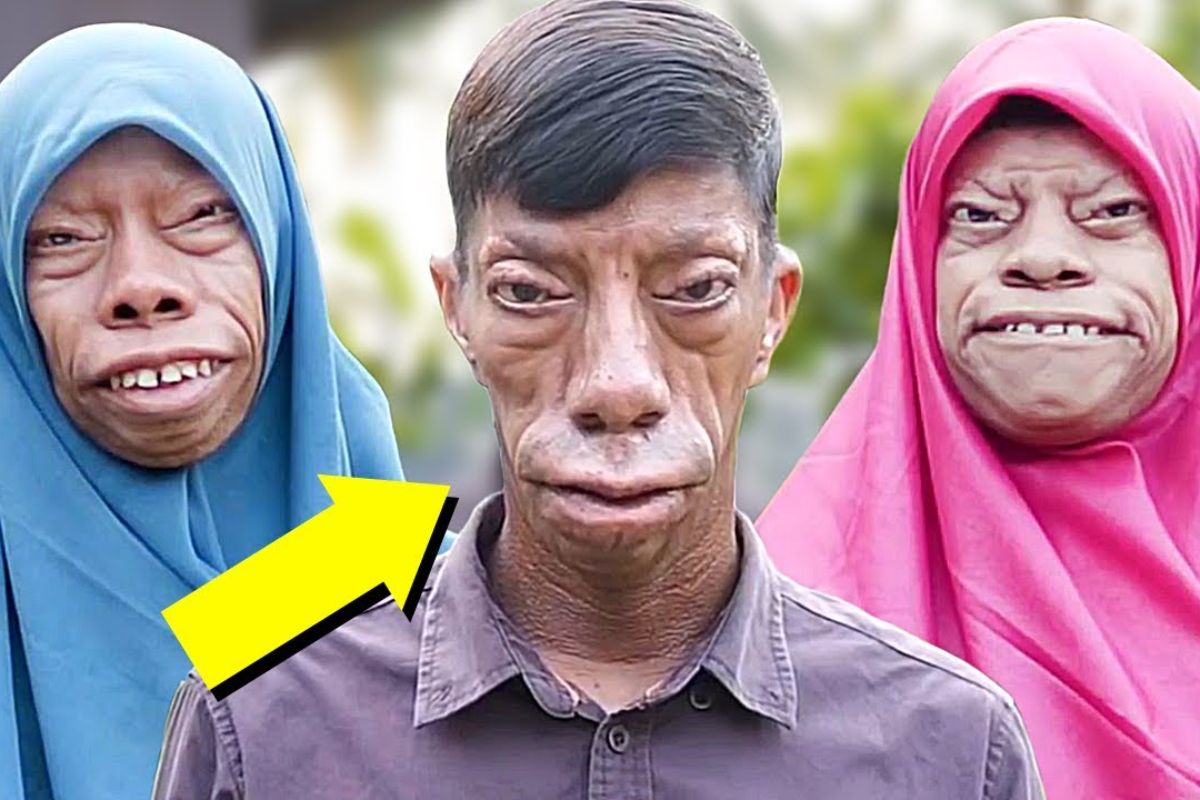 História de uma família com rostos que mudam de forma que enfrenta bullying, vive com rara síndrome genética, desafia o preconceito e transforma dor em união e esperança.