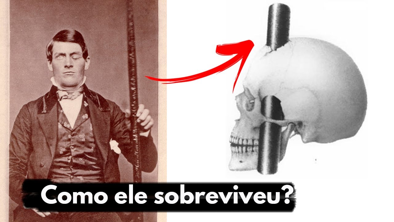 Com uma barra de ferro atravessando o crânio de 90 centímetros, o homem que sobreviveu ao acidente impossível e virou o caso mais famoso da neurociência moderna