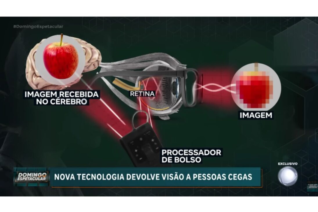 Una nueva tecnología usa microchip fotovoltaico implantado en la retina para devolver visión parcial, actuando en casos de degeneración macular y enfermedad de Stargardt y reacendiendo la esperanza de pacientes.