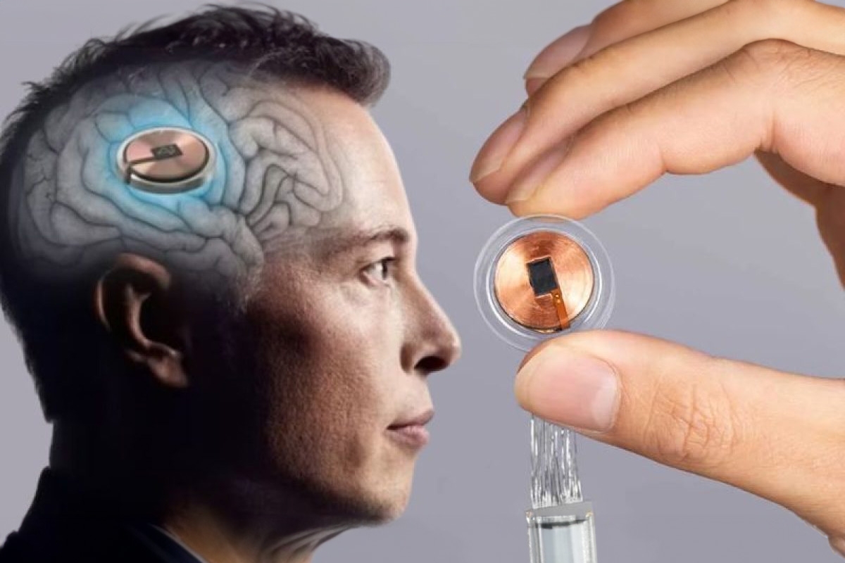Elon Musk planeja produção em grande escala de chips da Neuralink e cirurgia automatizada já em 2026