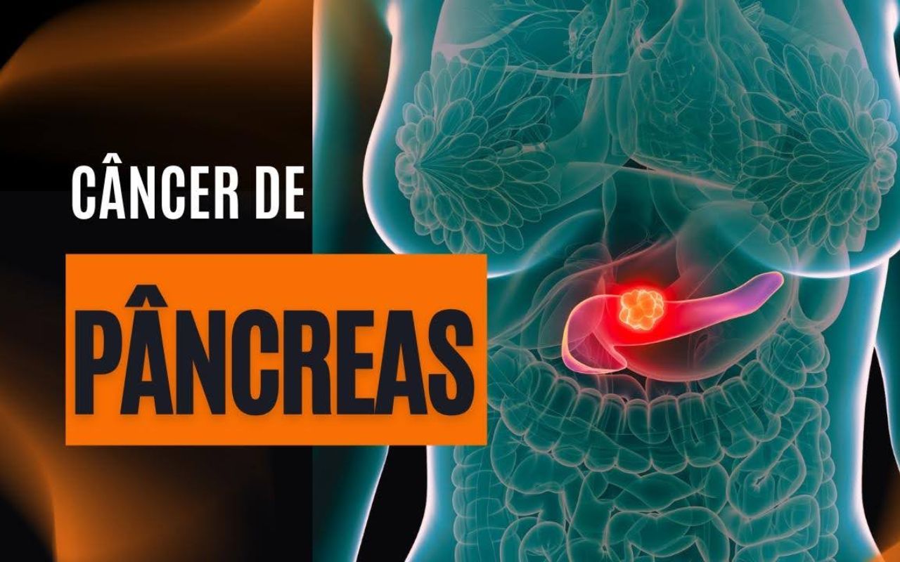 Pesquisa liderada por Mariano Barbacid mostra que combinação de medicamentos eliminou tumores de câncer de pâncreas em modelos animais com baixa toxicidade.