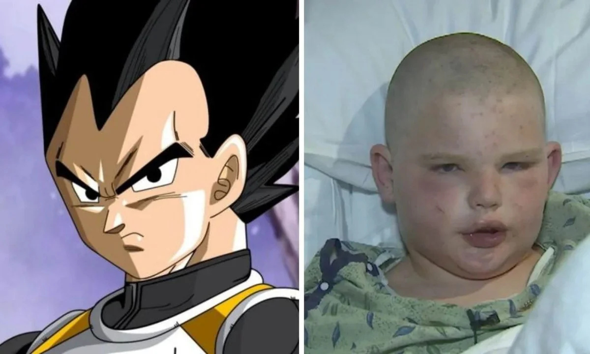 Menino sobrevive após ataque de abelhas africanizadas no Arizona e diz ter se inspirado em “Dragon Ball Z” durante as cerca de 400 ferroadas. (Imagem: Reprodução/Redes sociais)