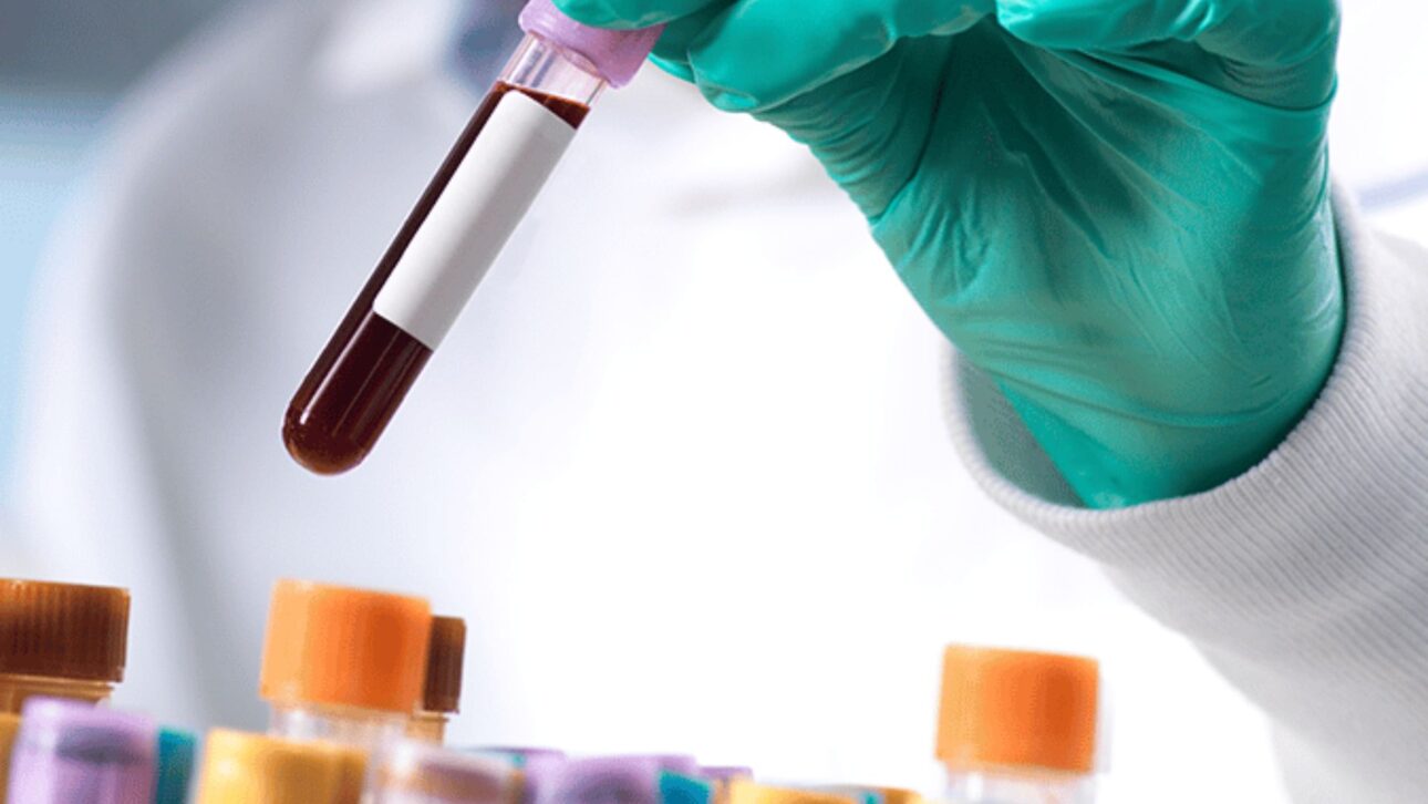 Japón inicia pruebas con sangre artificial universal que promete durar más de un año y puede llegar a los hospitales hasta 2030.